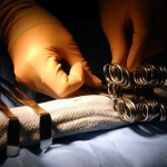 4 Steps to Take If You Are Injured During a Surgical Procedure